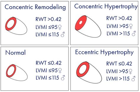 lvmi normal range